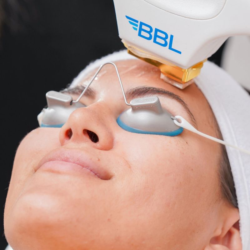 BBL Hero treatment process